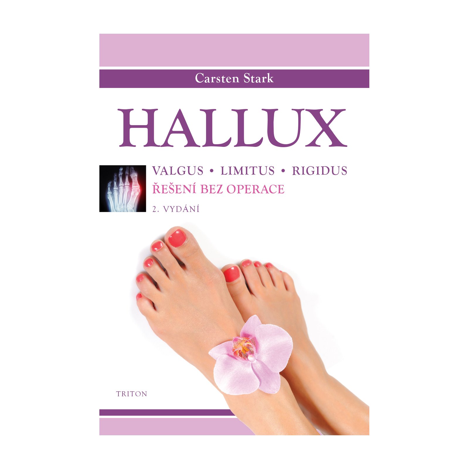 Hallux
